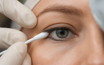Eyeliner Tattoo Removal: Reveal Fresh, Natural Eyes with Expert Removal Techniques