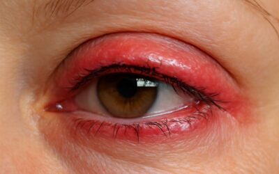 What you should know about permanent eyeliner infection symptoms and how to act fast.