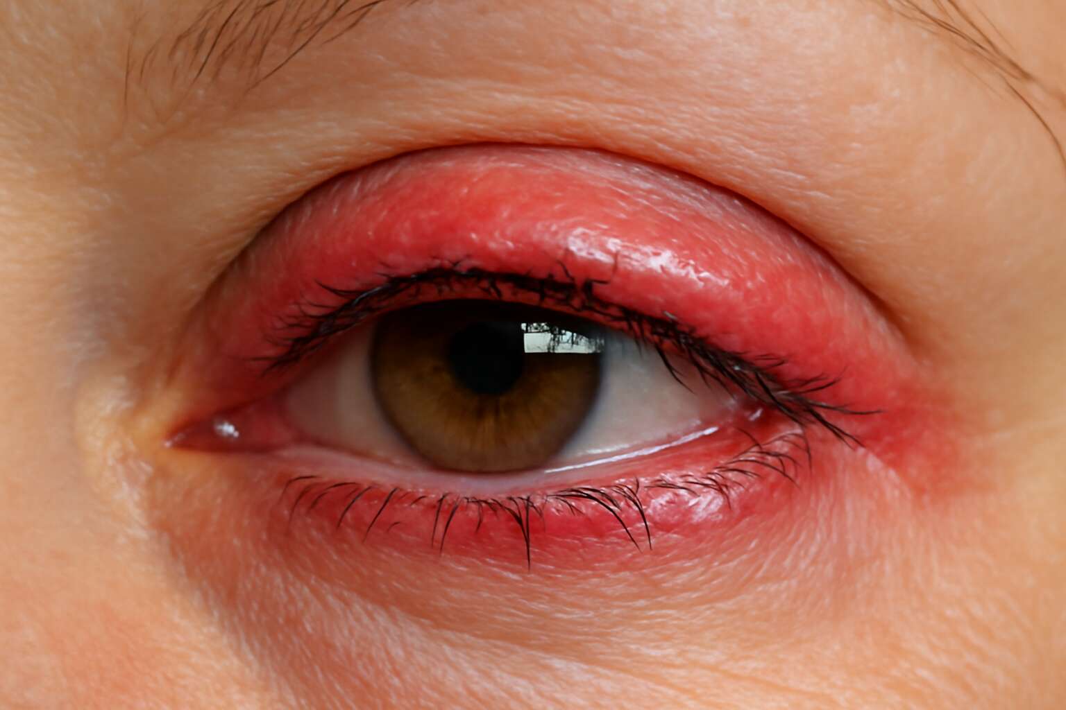 generated_image_692ff3ce62b66.jpg permanent eyeliner infection symptoms