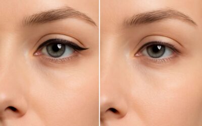 Unveiling permanent eyeliner removal before and after: dramatic, natural-looking results!