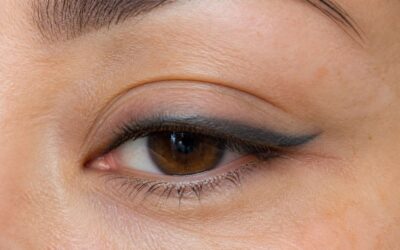When eyeliner tattoo aged poorly, here’s what to do.
